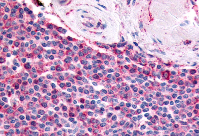 PTGES Antibody in Immunohistochemistry (Paraffin) (IHC (P))