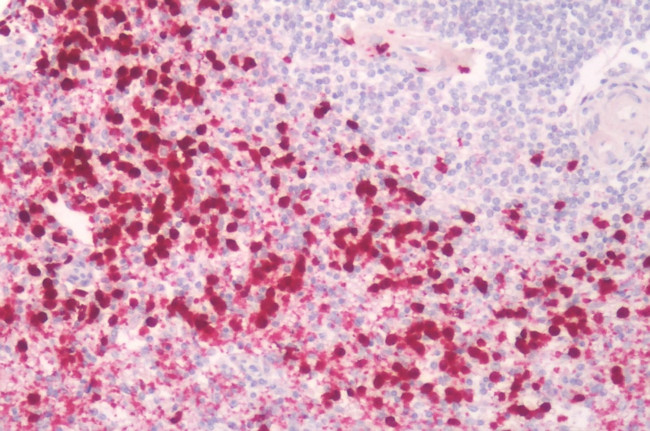 PTGES Antibody in Immunohistochemistry (Paraffin) (IHC (P))