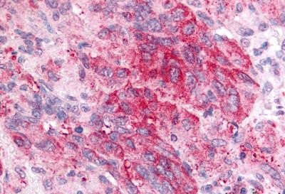 PTGES Antibody in Immunohistochemistry (Paraffin) (IHC (P))