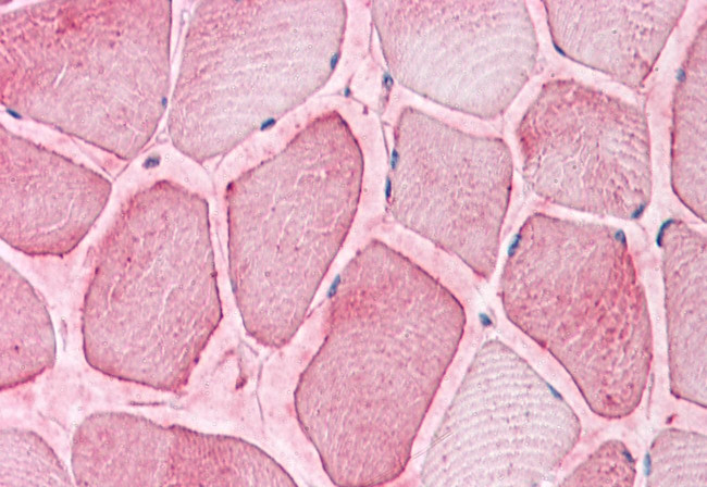 SEMA4B Antibody in Immunohistochemistry (Paraffin) (IHC (P))