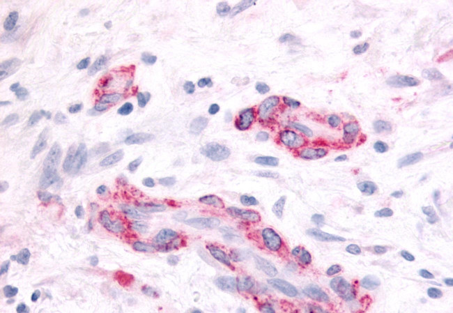 SGK2 Antibody in Immunohistochemistry (Paraffin) (IHC (P))