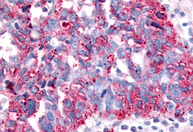 SGK2 Antibody in Immunohistochemistry (Paraffin) (IHC (P))