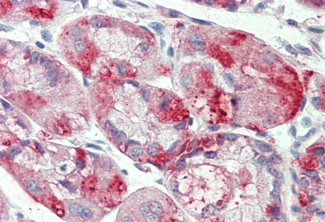 NKCC1 Antibody in Immunohistochemistry (Paraffin) (IHC (P))