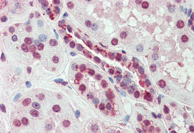 SLC44A2 Antibody in Immunohistochemistry (Paraffin) (IHC (P))