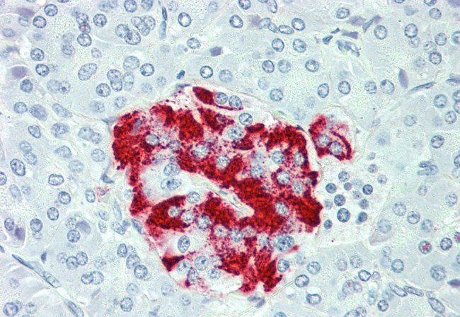 SLC7A2 Antibody in Immunohistochemistry (Paraffin) (IHC (P))