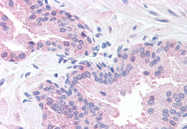 SLITRK6 Antibody in Immunohistochemistry (Paraffin) (IHC (P))