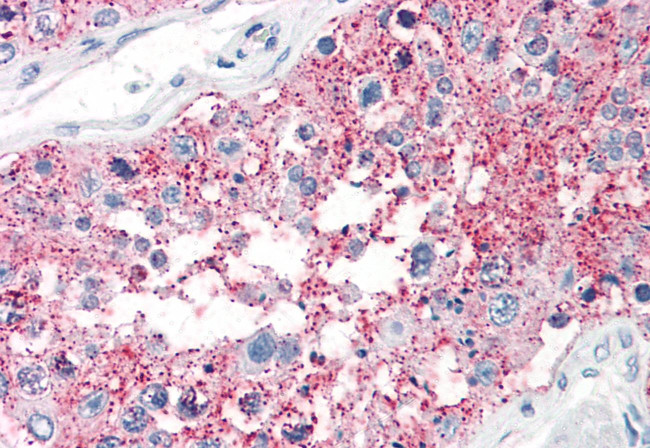 SRPX2 Antibody in Immunohistochemistry (Paraffin) (IHC (P))