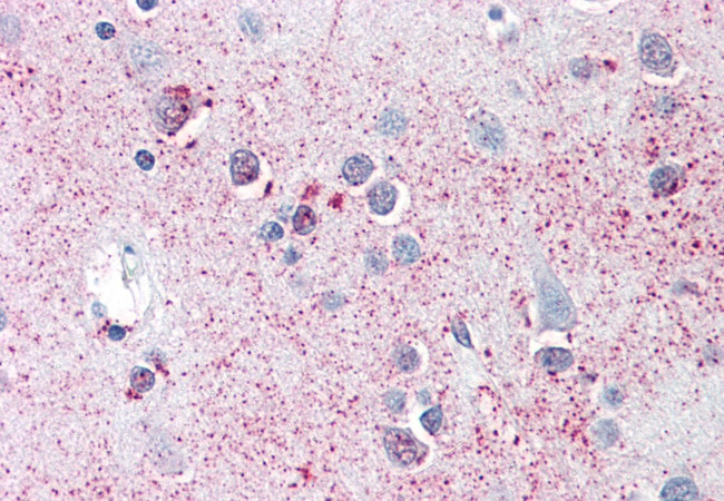 SRPX2 Antibody in Immunohistochemistry (Paraffin) (IHC (P))