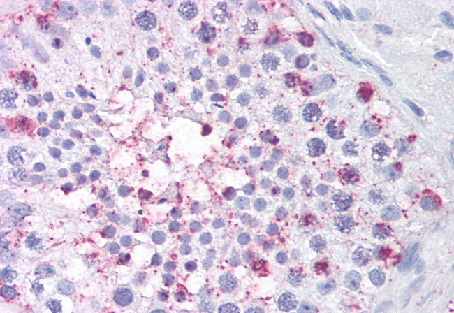 USP2 Antibody in Immunohistochemistry (Paraffin) (IHC (P))