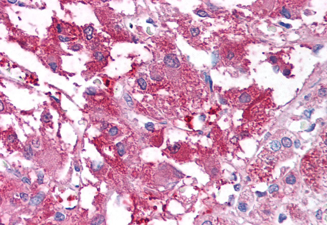 USP20 Antibody in Immunohistochemistry (Paraffin) (IHC (P))