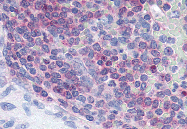 XCR1 Antibody in Immunohistochemistry (Paraffin) (IHC (P))