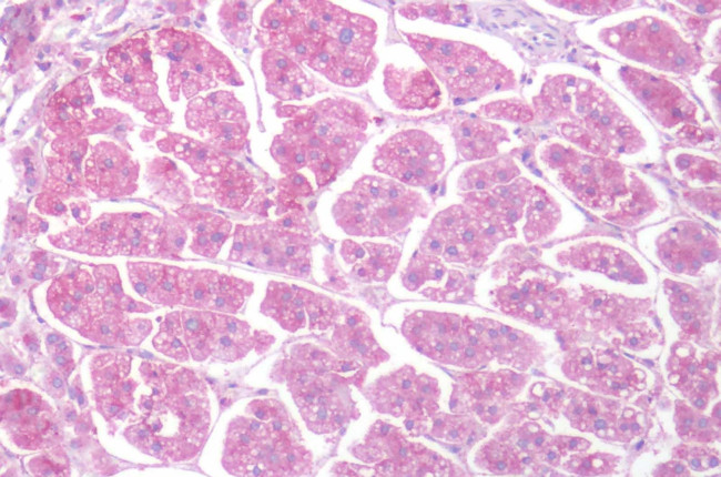 HTR1D Antibody in Immunohistochemistry (Paraffin) (IHC (P))