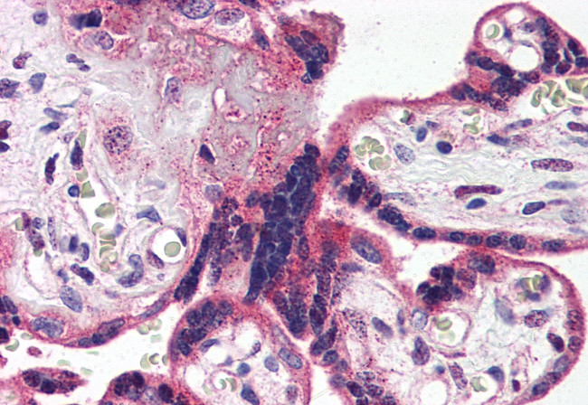 HTR2A Antibody in Immunohistochemistry (Paraffin) (IHC (P))