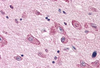 HTR7 Antibody in Immunohistochemistry (Paraffin) (IHC (P))