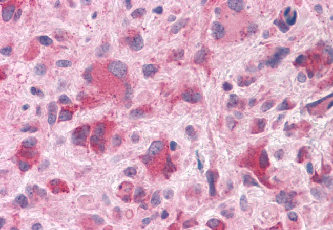 HTR7 Antibody in Immunohistochemistry (Paraffin) (IHC (P))