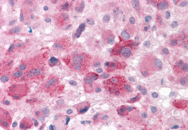 HTR7 Antibody in Immunohistochemistry (Paraffin) (IHC (P))