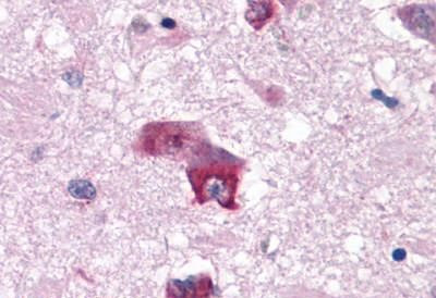 HTR7 Antibody in Immunohistochemistry (Paraffin) (IHC (P))