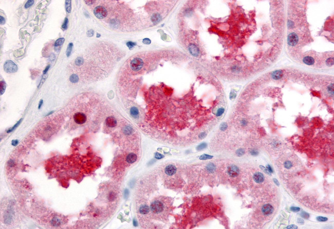 P-Glycoprotein Antibody in Immunohistochemistry (Paraffin) (IHC (P))