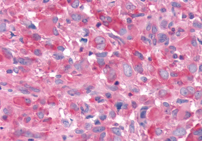 ADORA1 Antibody in Immunohistochemistry (Paraffin) (IHC (P))