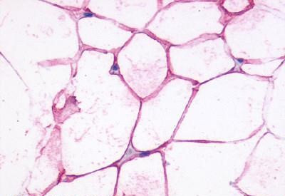 beta-3 Adrenergic Receptor Antibody in Immunohistochemistry (Paraffin) (IHC (P))