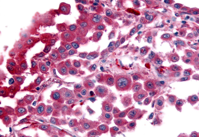 AVPR1B Antibody in Immunohistochemistry (Paraffin) (IHC (P))