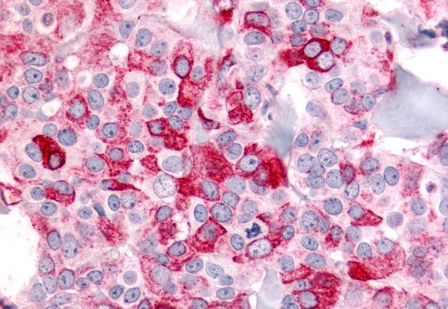 BAI2 Antibody in Immunohistochemistry (Paraffin) (IHC (P))