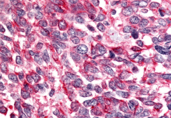 BAI2 Antibody in Immunohistochemistry (Paraffin) (IHC (P))