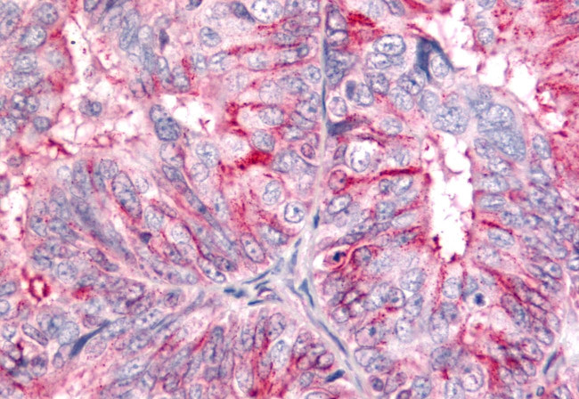 BAI2 Antibody in Immunohistochemistry (Paraffin) (IHC (P))