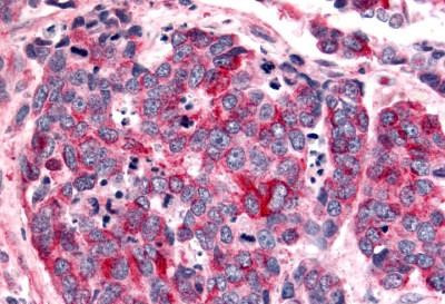 BAI2 Antibody in Immunohistochemistry (Paraffin) (IHC (P))