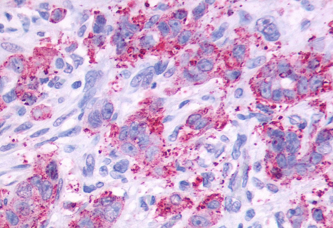 CCKBR Antibody in Immunohistochemistry (Paraffin) (IHC (P))