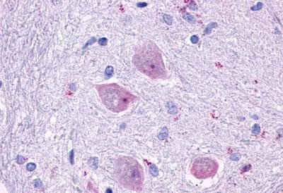 CHRM4 Antibody in Immunohistochemistry (Paraffin) (IHC (P))