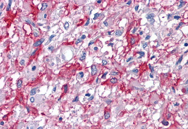 CNR2 Antibody in Immunohistochemistry (Paraffin) (IHC (P))