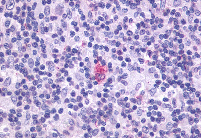 CXCR5 Antibody in Immunohistochemistry (Paraffin) (IHC (P))