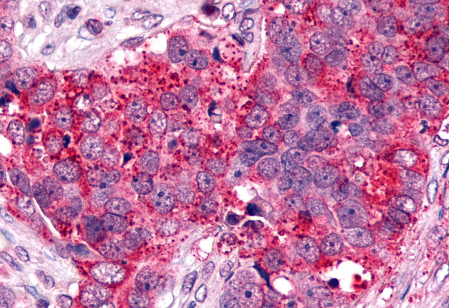 CXCR6 Antibody in Immunohistochemistry (Paraffin) (IHC (P))