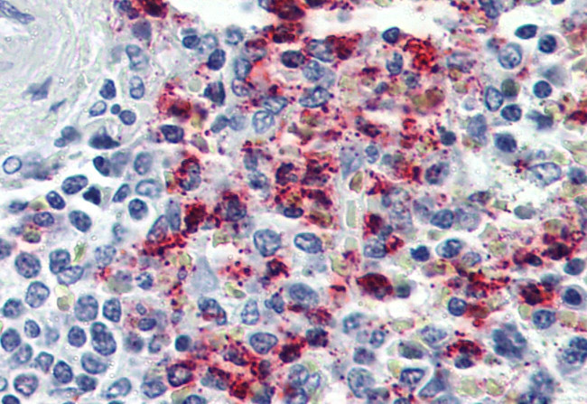 CYSLTR2 Antibody in Immunohistochemistry (Paraffin) (IHC (P))