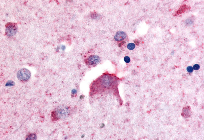 DPP6 Antibody in Immunohistochemistry (Paraffin) (IHC (P))