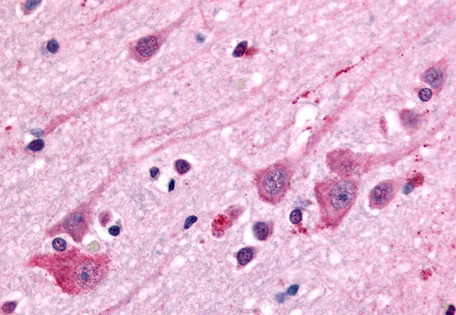 DRD1 Antibody in Immunohistochemistry (Paraffin) (IHC (P))