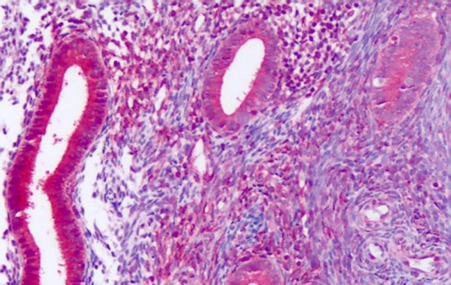 DUSP23 Antibody in Immunohistochemistry (Paraffin) (IHC (P))