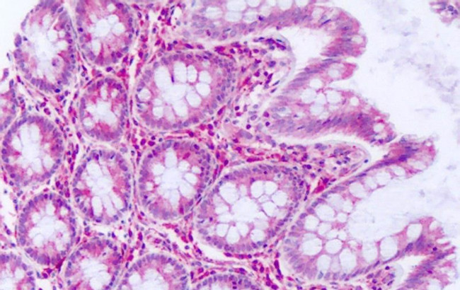 DUSP23 Antibody in Immunohistochemistry (Paraffin) (IHC (P))