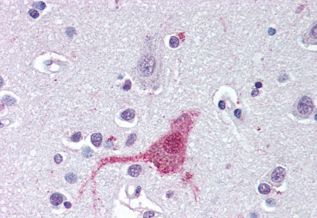 Endothelin B Receptor Antibody in Immunohistochemistry (Paraffin) (IHC (P))