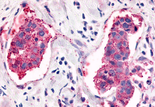 ELTD1 Antibody in Immunohistochemistry (Paraffin) (IHC (P))