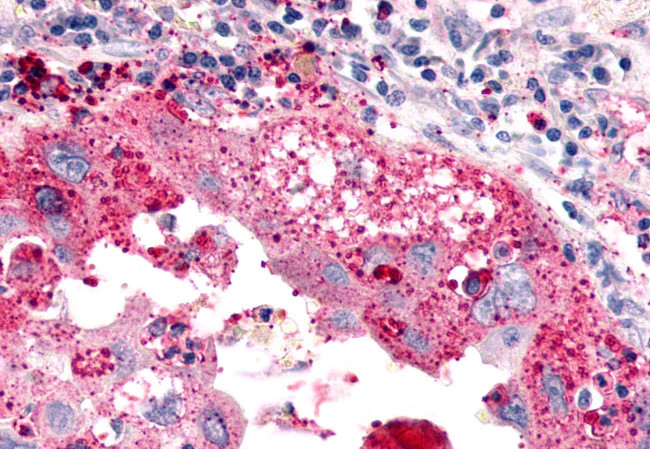 ELTD1 Antibody in Immunohistochemistry (Paraffin) (IHC (P))