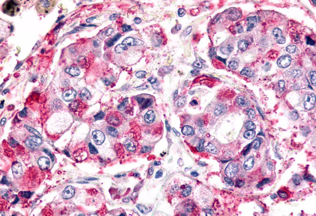 ELTD1 Antibody in Immunohistochemistry (Paraffin) (IHC (P))