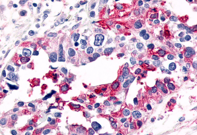 ELTD1 Antibody in Immunohistochemistry (Paraffin) (IHC (P))