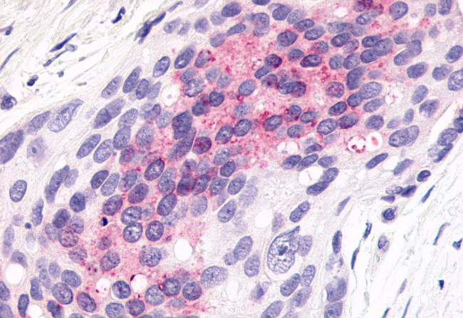 ELTD1 Antibody in Immunohistochemistry (Paraffin) (IHC (P))