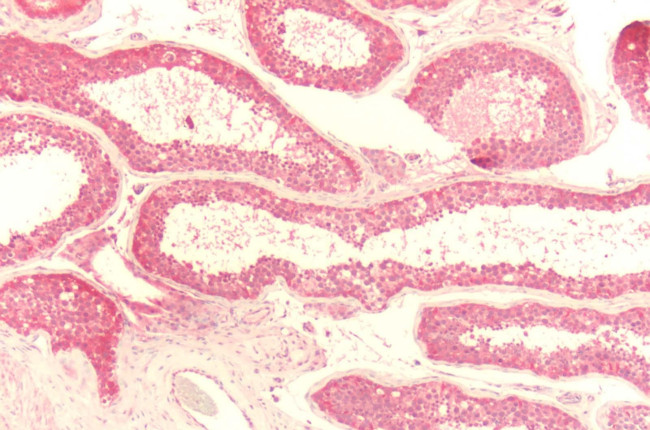 F4/80 Antibody in Immunohistochemistry (Paraffin) (IHC (P))