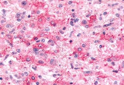 EMR2 Antibody in Immunohistochemistry (Paraffin) (IHC (P))