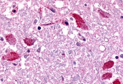 EMR2 Antibody in Immunohistochemistry (Paraffin) (IHC (P))