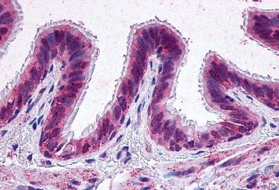 PTGER2 Antibody in Immunohistochemistry (Paraffin) (IHC (P))