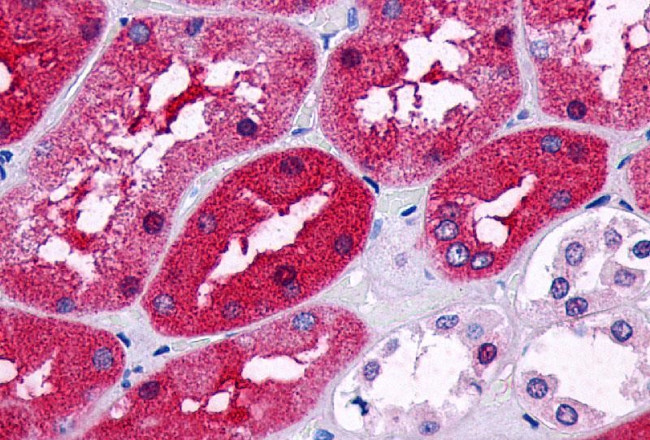 PTGER2 Antibody in Immunohistochemistry (Paraffin) (IHC (P))